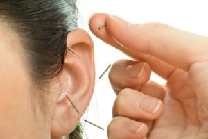 40882621 - acupuncture therapy on auricle, horizontal very close up photo