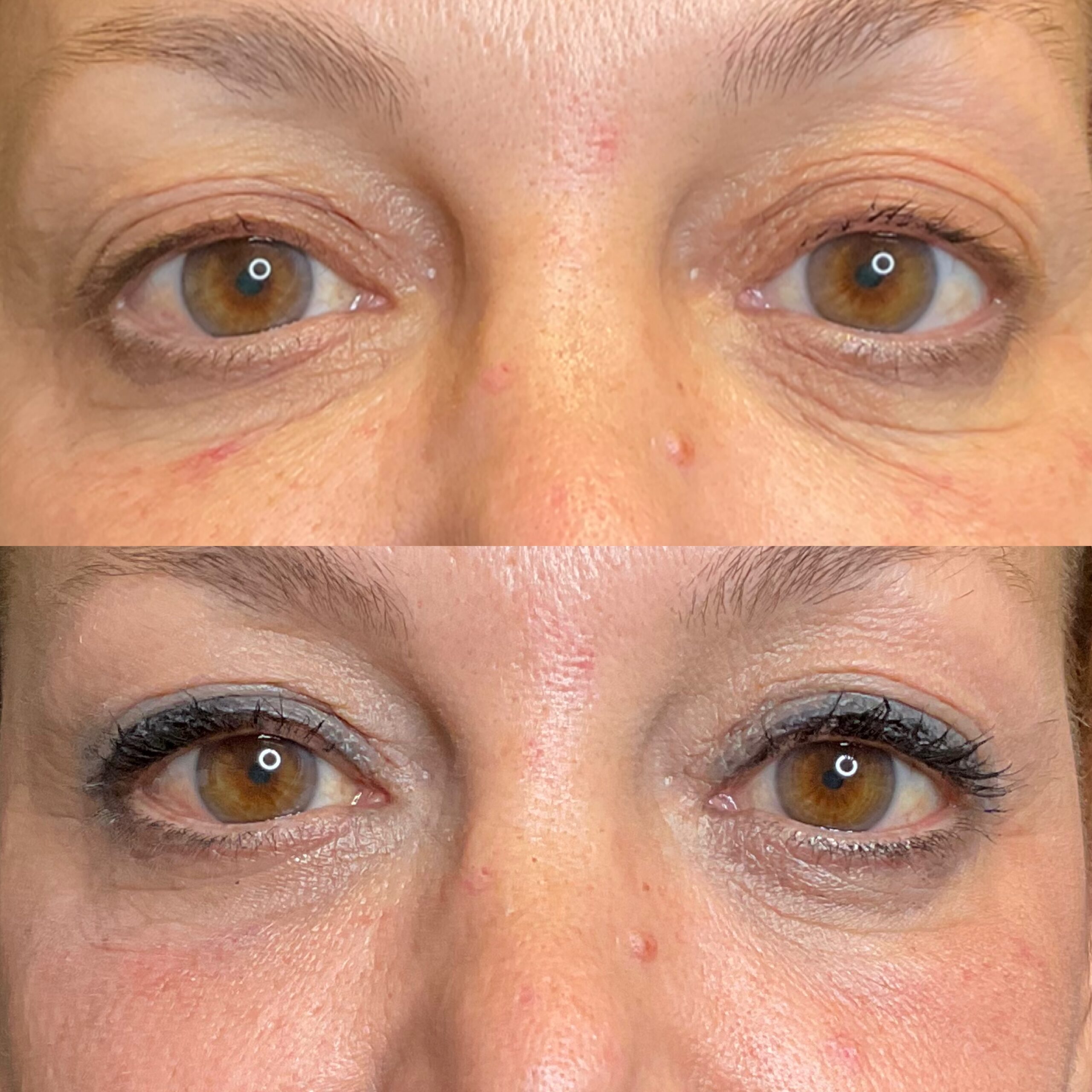 CoolPeel- Eyes- 1 treatment