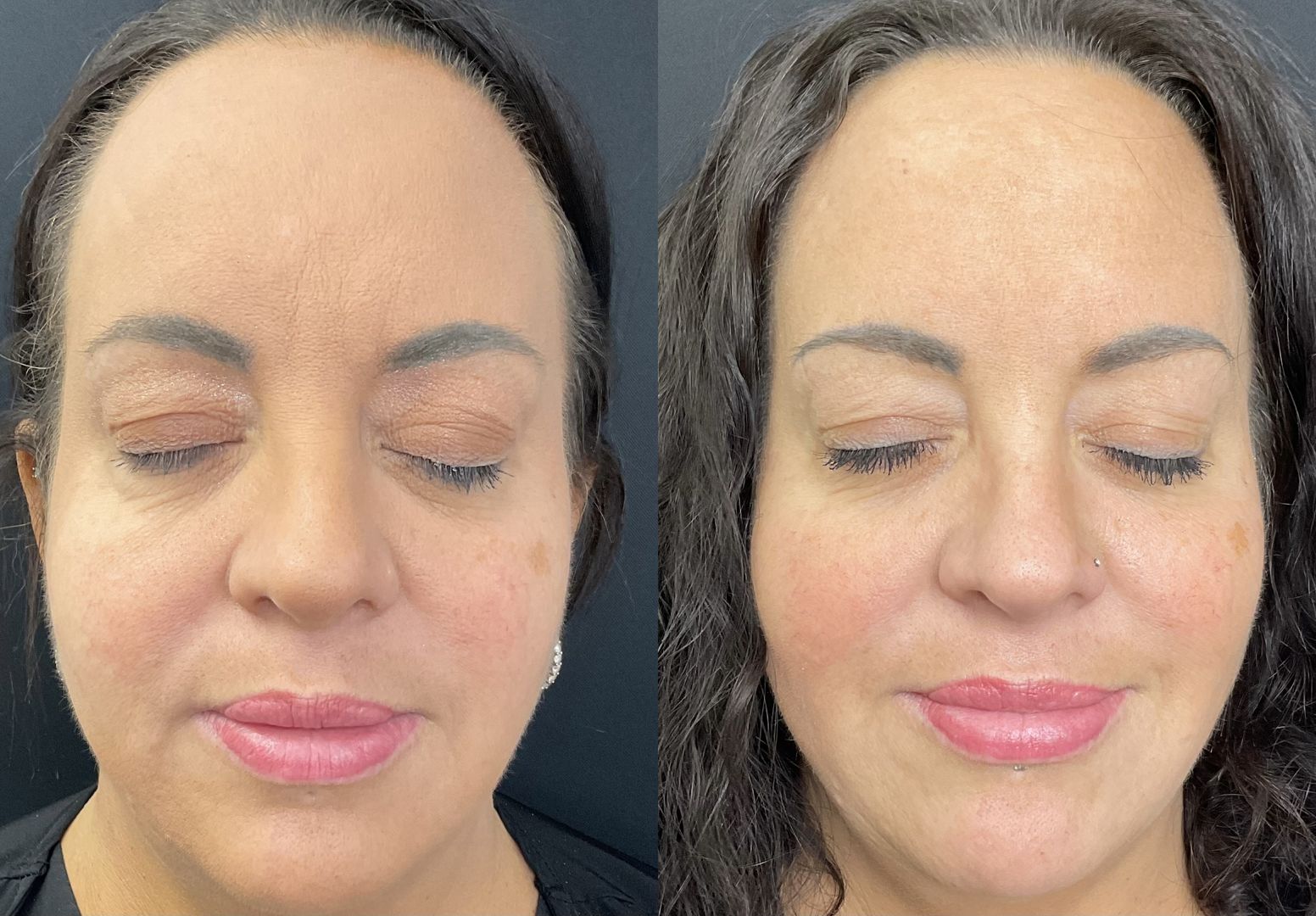 Skinvive for Texture and Pores_result