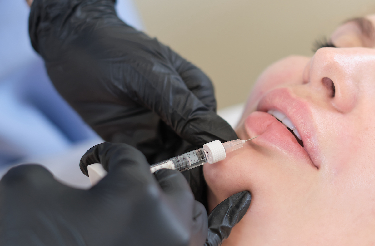 This close up features a woman receiving lip filler injections after searching "lip filler near me" and discovering Hermann Aesthetics