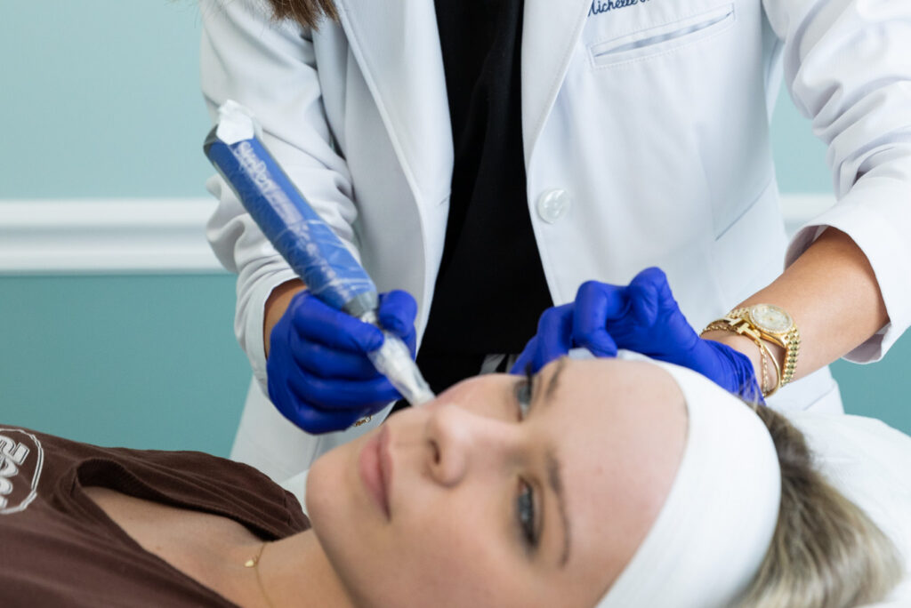A Hermann provider administers a patient's microneedling for wrinkles in St. Petersburg. 